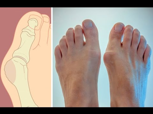 Секреты антикосточки и греческой стопы - Маматов (_0.png